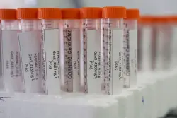 Oakdale PFAS project would divert water around former 3M dump